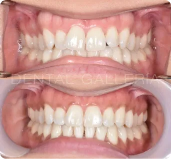 Invisalign Dentist Putney
