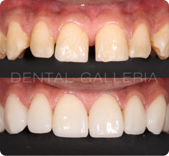 Cosmetic Dentist Ryde