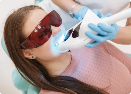 Teeth Whitening in Putney